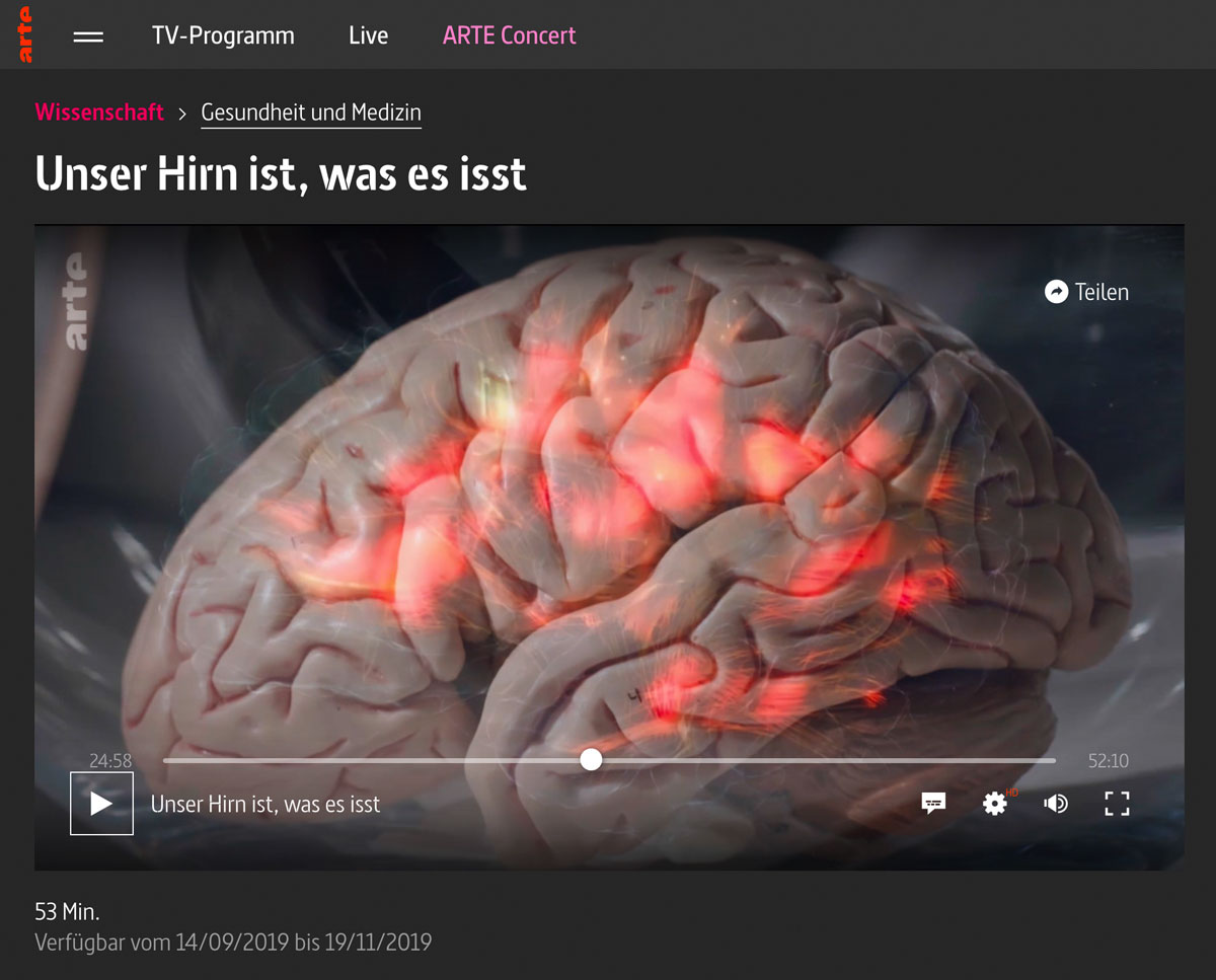 Unser Hirn ist, was es isst